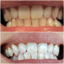 Load image into Gallery viewer, Snow® At-Home Teeth Whitening Kit